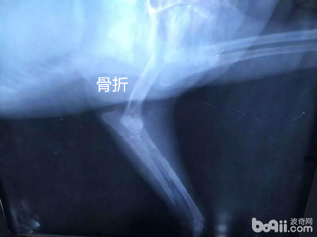 骨折的X光片