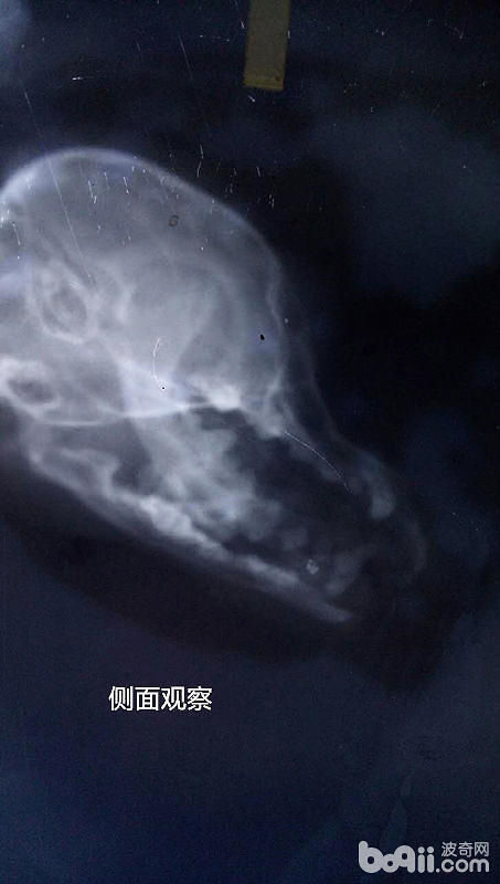 頭部骨折的X光片