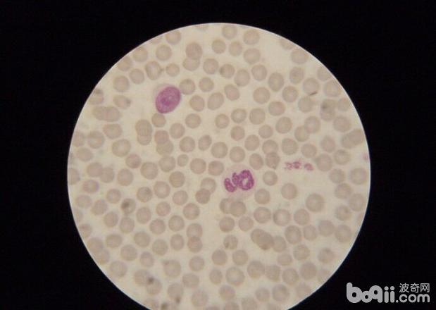 圖5 正常的犬紅細胞的形態