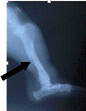 流浪犬胫腓骨骨折，X線顯示骨頭錯位。