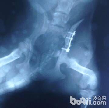 流浪犬髂骨植入鋼板固定物，對於胫腓骨骨頭錯位外固定方法。
