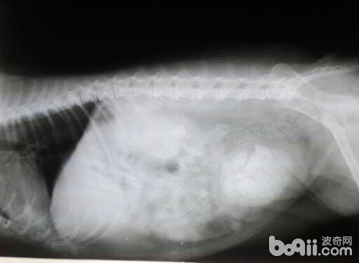  X光片，一個病例中膀胱內結石。
