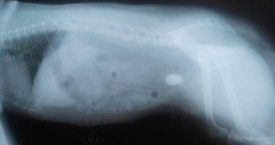 X光下，另一個病例中膀胱內結石。