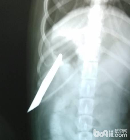 X光腹背位探查刀刺入的深度和寬度