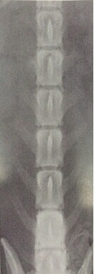 圖4.2.3 C腰椎腹背位正常X線片