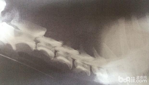 圖4.3 A 正常頸椎造影X線片