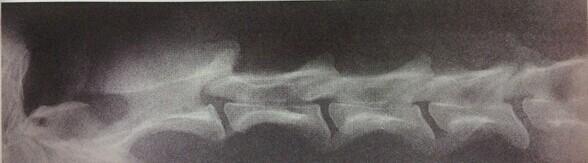 圖4.2.1 B正常頸椎側位X線片
