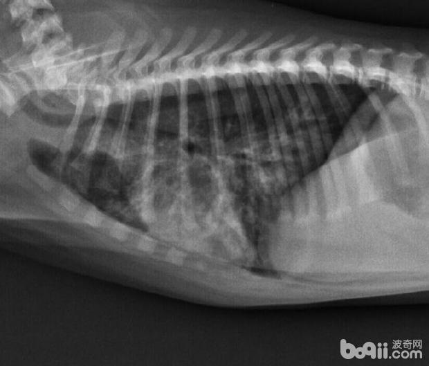 X-光影像顯示肺部感染