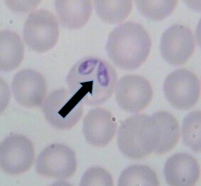 犬巴貝斯蟲，寄生在紅細胞中，曾銳角、梨狀成對排列，4um*7um。箭頭方向