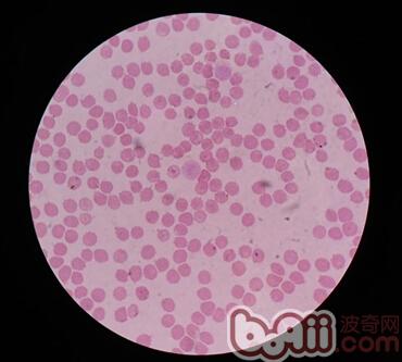 血塗片箭頭所指巴貝斯蟲紅細胞內有黑色圓點，個別紅細胞形狀發生改變。