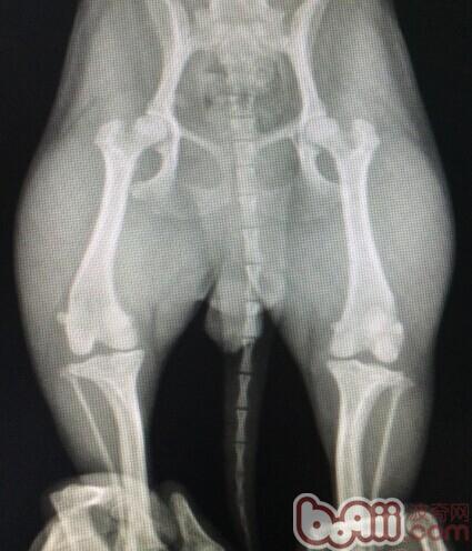 圖2  X光檢查顯示髌骨脫出滑車
