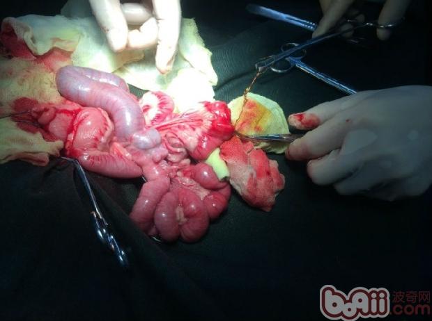 圖4 條索狀異物,腸道不同部位切開取出異物