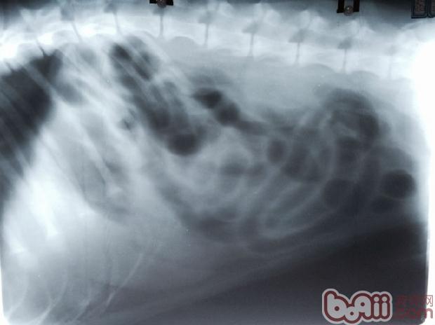 X光顯示大量氣體充滿腸道內，懷疑有阻塞位置