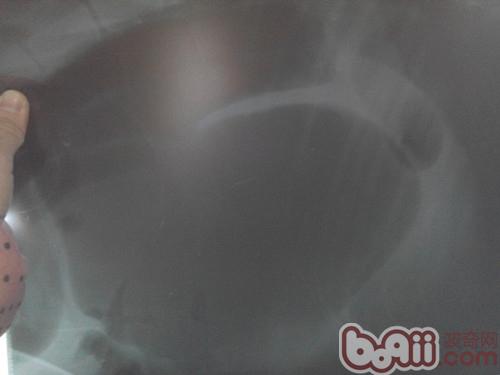 X光檢查，顯示胃部增大，氣體充滿整個胃部（左側位）。黑色陰影部分。