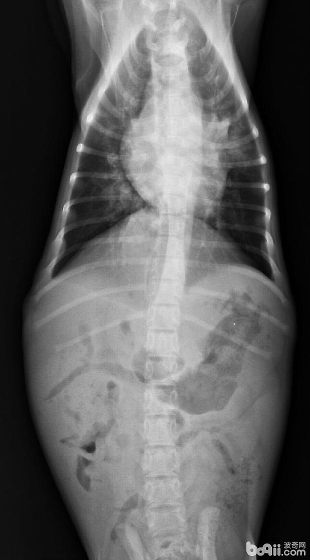X-光影像顯示肺部感染