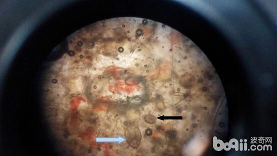  顯微鏡下，疥螨和卵。藍色箭頭為螨蟲成蟲，黑色箭頭為螨蟲卵。在一個視野下看到一只螨蟲和多個螨蟲卵，說明此次感染處在活動期。