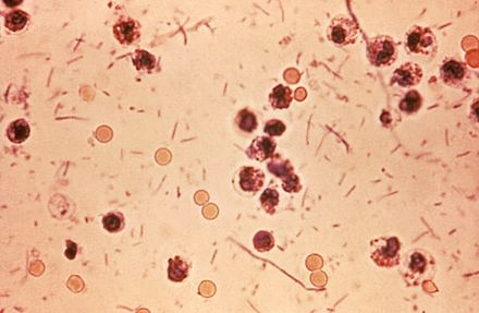 圖3 顯微鏡下的痢疾桿菌