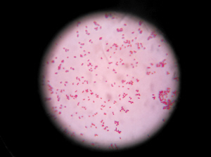 圖2 顯微鏡下的大腸桿菌