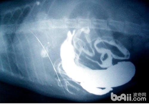 巨結腸的X光片