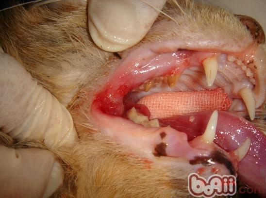 貓嚴重的牙結石和口腔粘膜潰瘍。通常貓的牙周炎不會造成口腔粘膜的出血和潰瘍，但是貓的反復性口炎，則多見上圖的狀況