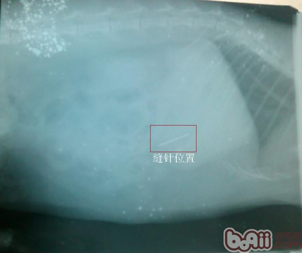 X光片清晰顯示縫針的位置