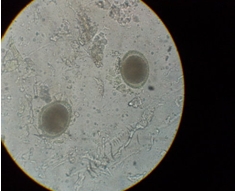 顯微鏡下的蛔蟲卵