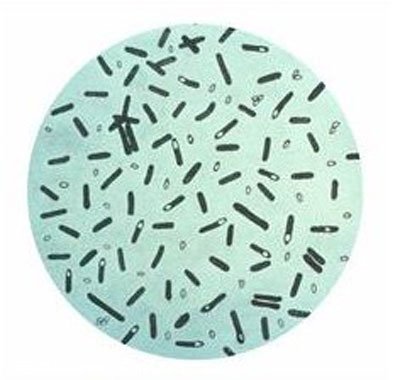 什麼是肉毒梭菌？肉毒梭菌的症狀及治療方法