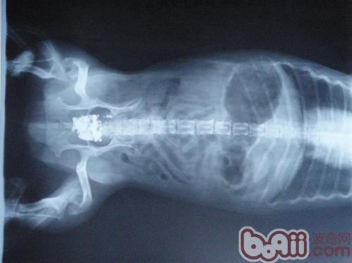 腸道梗阻