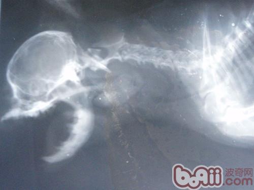 咽喉梗阻