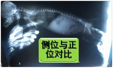 腸道內有異物