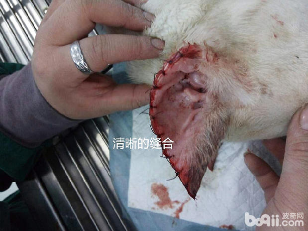 杜高立耳手術