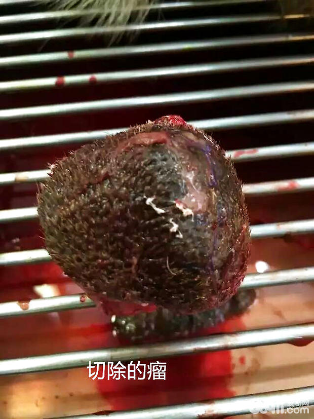 切除的骨肉瘤