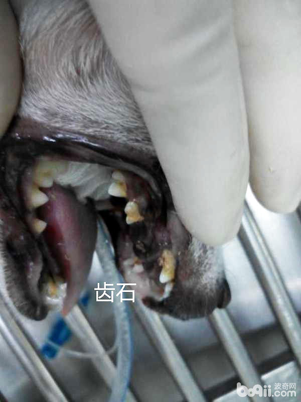 犬牙結石