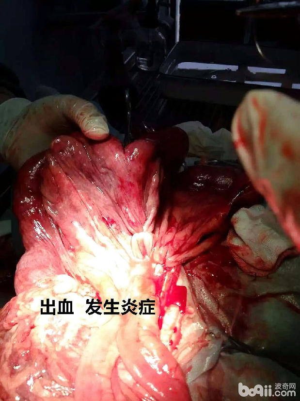 炎症