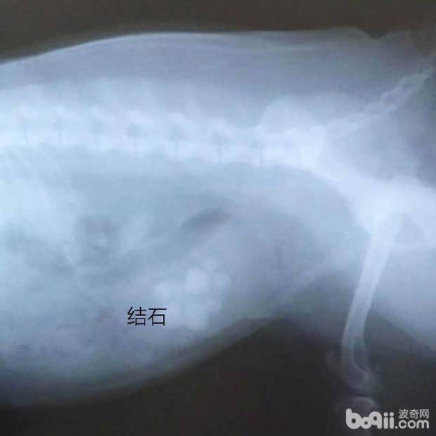 X光片下的結石