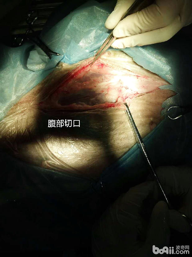 手術治療