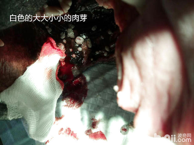 口腔內的肉芽