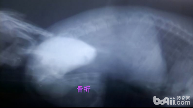 X光片可見骨折
