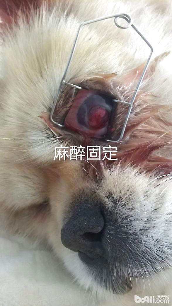 麻醉固定