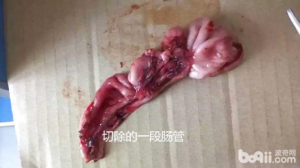 切除的一段腸管