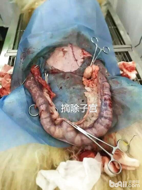 摘除下來的子宮