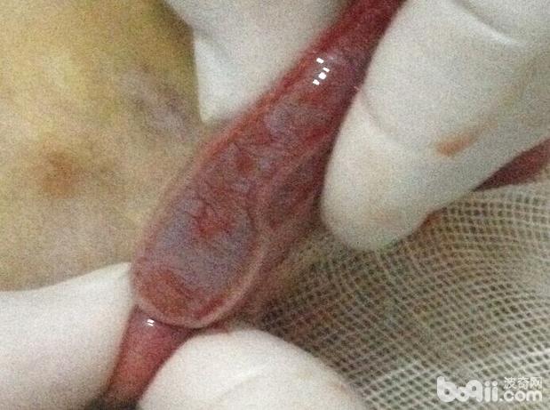 如圖所示，另一腸管套疊處，可見套入腸管外側由於壓力過大導致漿膜層破裂，並且伴有少量出血。最後排查所有是否還有嵌入的腸管。最後排查共有4處套入，套入的長度較長。
