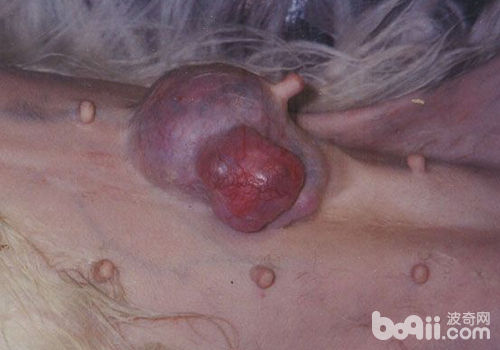 腫瘤引起的包