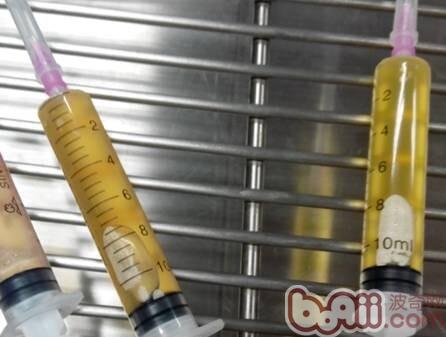 抽取的部分積液，淡黃色，清亮。抽出的積液可以做抹片，積液比重的檢查。一次抽取積液大約有80ml積液。
