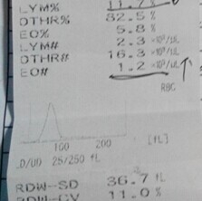 Amy澱粉酶降低，來自胰腺，消化澱粉和脂肪，由腎髒排出，可能跟營養不良有關。CPK肌酸激酶增高，是肌肉儲存能量重要的一種酶。顯示退化性或者營養性疾病或者是運動過多，或者是采血時過度反抗都會造成該酶的升高。臨床生化指標和血常規指標應嚴格根據該病例的病史和臨床症狀做出綜合分析。