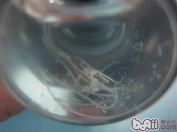 圖3  從犬眼中取出的線蟲