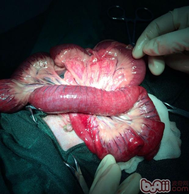 將部分壞死腸管切除後進行大網膜包裹腸壁端端處，沖洗後放入腹腔，並用大量生理鹽水配合氨苄西林沖洗腹腔，最後配以替硝唑及慶大霉素置於腹腔內進行消炎控制。