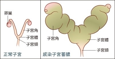 犬子宮蓄膿