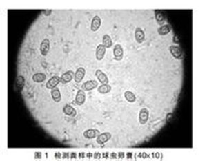 纖維鏡下的球蟲