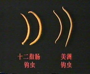鉤蟲